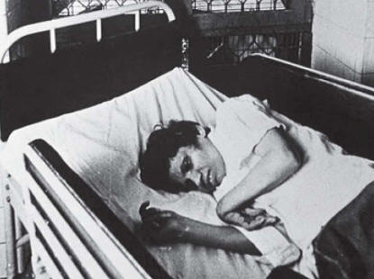 Aruna Shanbaug in Kem Hospital