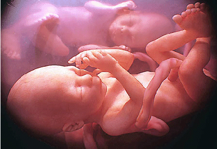 Abortion: Setting the Matter Straight  by Amarendra Dasa